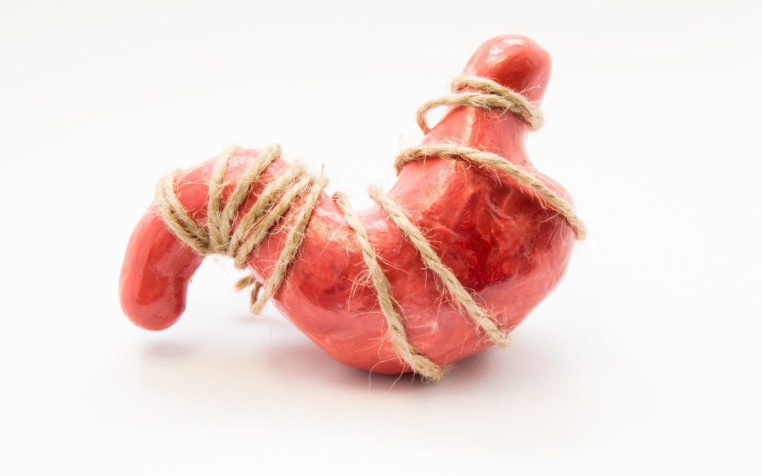 Understanding Weight Loss Surgery