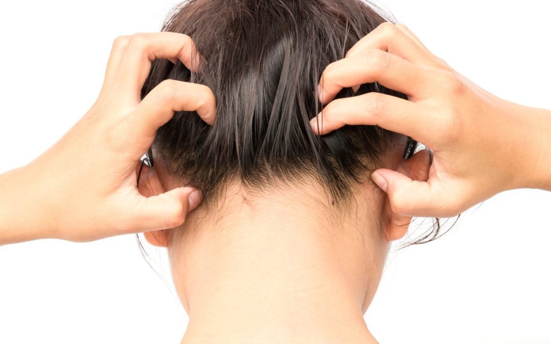 The Cure for Dry, Itchy Scalp